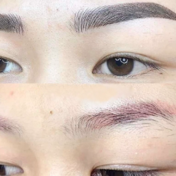 XỬ LÝ MÍ MẮT BỊ ĐỎ, XANH