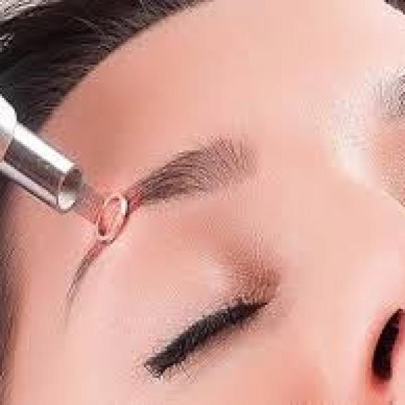 XÓA MÀY LASER 1 LẦN