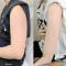 GỌN CƠ BẮP TAY