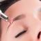 XÓA MÀY LASER 1 LẦN