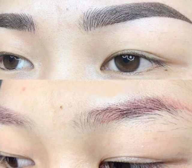 XỬ LÝ MÍ MẮT BỊ ĐỎ, XANH